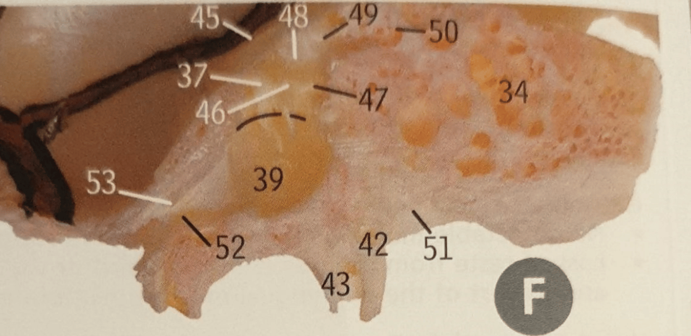 A sagittal cut through the middle ear. 