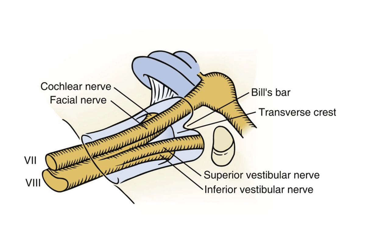 Contents of the internal acoustic canal, which shows the relation of the facial nerve to Bill’s bar.