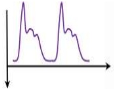 A purple line graph with a black line AI-generated content may be incorrect.