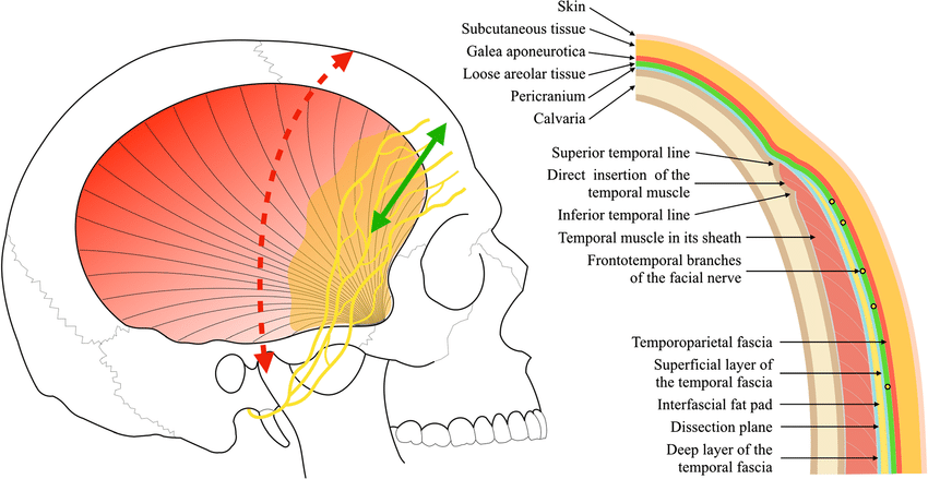 Anatomy of the temporal region. At left: right-sided view of the... | Download Scientific Diagram