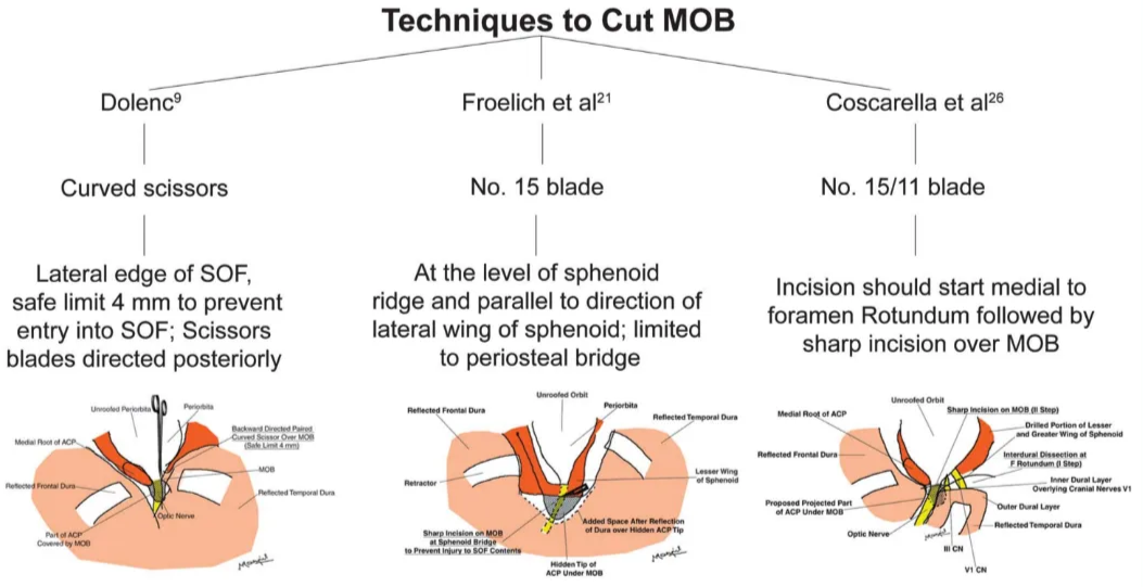 Dolenc9 Curved scissors Lateral edge of SOF, safe limit 4 mm to prevent entry into SOF; Scissors blades directed posteriorly Techniques to Cut MOB Froelich et a121 No. 15 blade At the level of sphenoid ridge and parallel to direction of Coscarella et a126 No. 15/11 blade Incision should start medial to foramen Rotundum followed by lateral wing of sphenoid; limited sharp incision over MOB to periosteal bridge FIGURE 6. Different techniques to cut the meningo-orbital band (MOB) at the anterior clinoid process (ACP). F, foramen; SOF, superior orbital fissure; VI, ophthalmic division of the trigeminal nerve. 