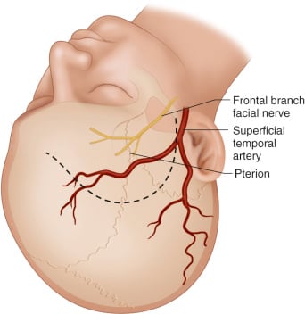 Frontal b facial nerve Superficial temporal artery 