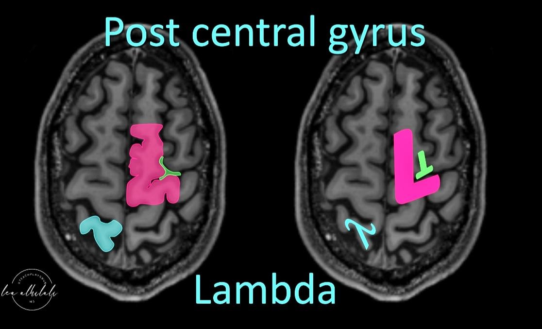 os central gyrus Lambda 