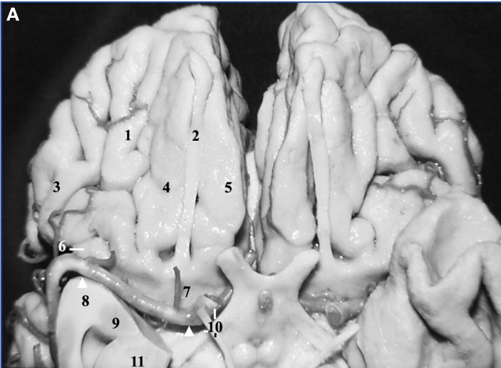 A close-up of a brain AI-generated content may be incorrect.