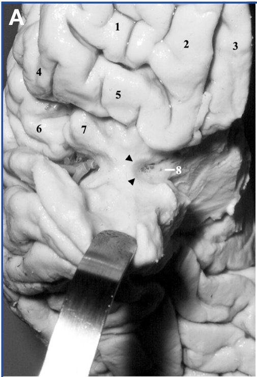 A close-up of a human body AI-generated content may be incorrect.