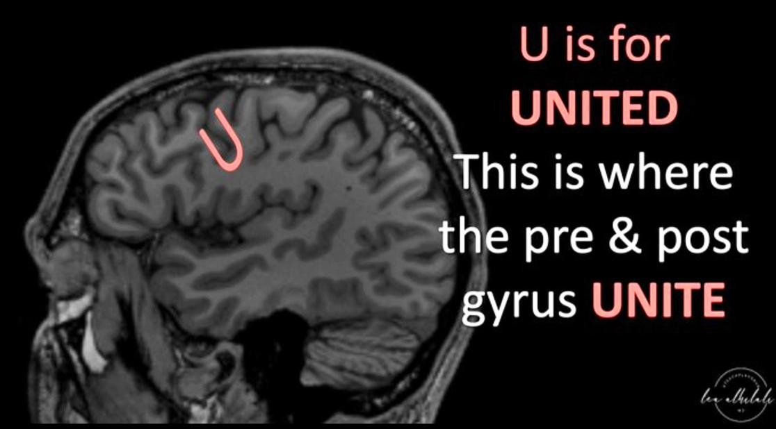 U is for UNITED his is where the pre & post ' gyrus UNITE 