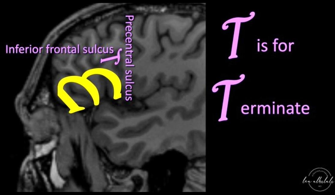 Inferio ronta/s is for erminate 