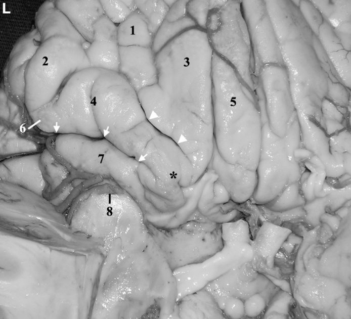 A close-up of a brain AI-generated content may be incorrect.