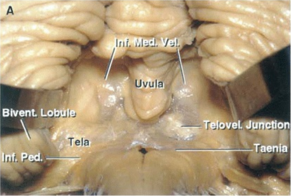 gıuaeı eıaı I on ıuaAIB 