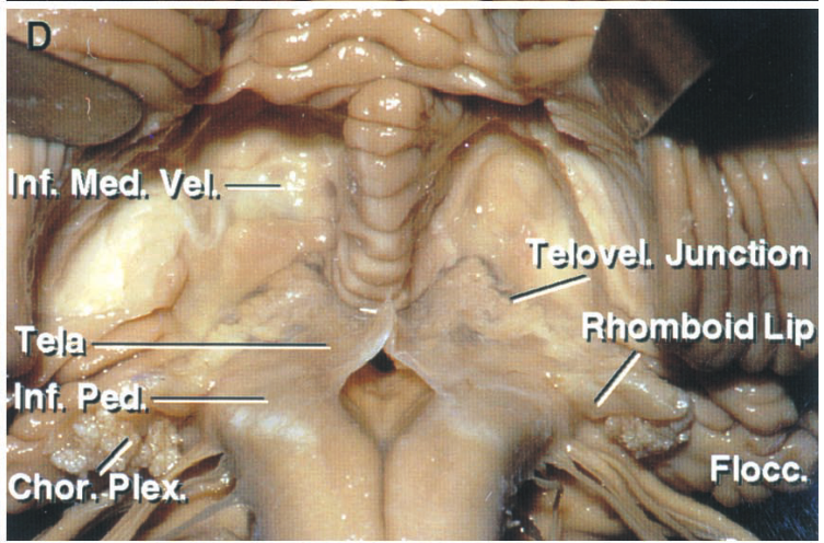 nf. Med I. Junction boid Lip Floec. 