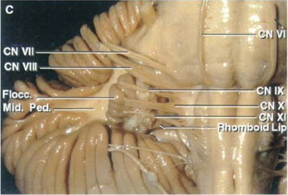 CN vil Floc MidV. Ped. old Li 