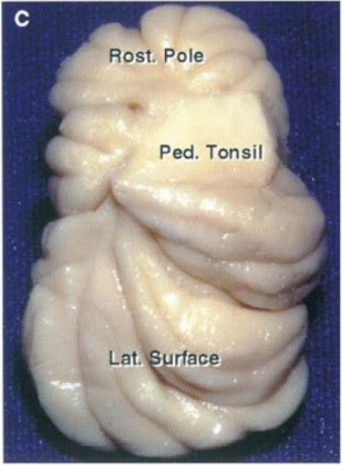 Rost. Pole Ped. Tonsil Lat. rfacę6ăat:• 