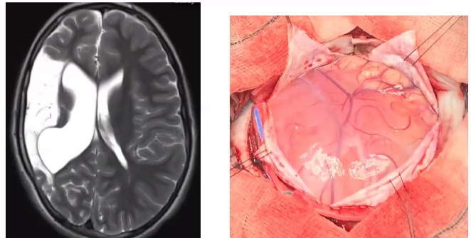 Do well after surgery