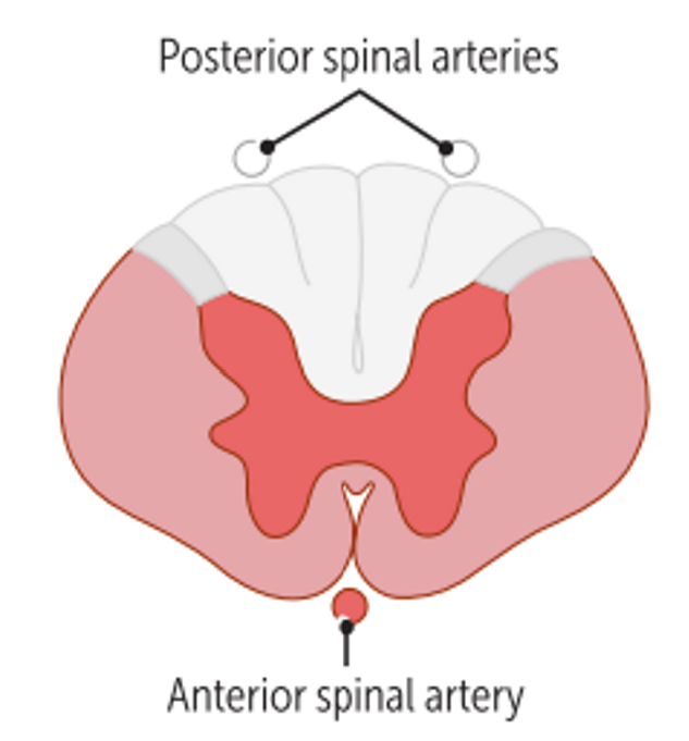 Anterior spinal artery occlusion