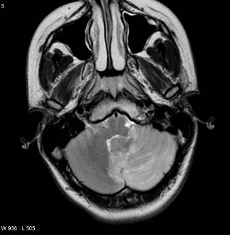 A close-up of a mri scan AI-generated content may be incorrect.