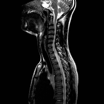 A x-ray of a person's head AI-generated content may be incorrect.