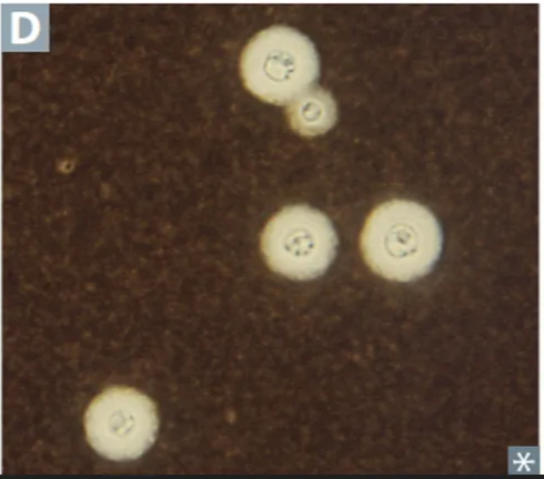 Cryptococcus neoformans