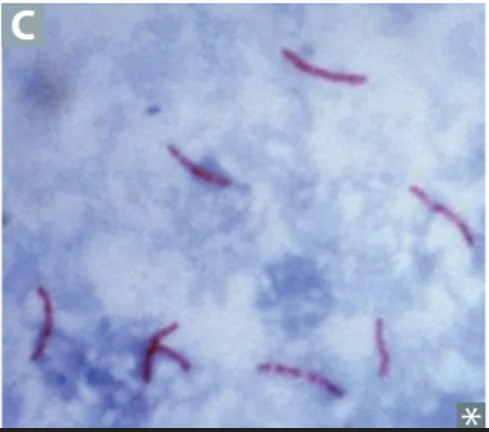 Mycobacteria