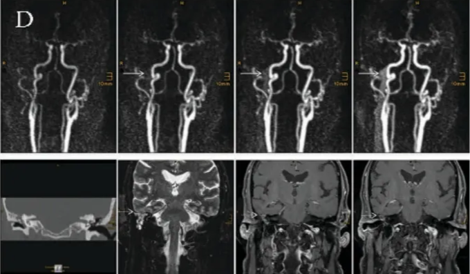 A close-up of a brain scan AI-generated content may be incorrect.