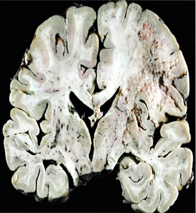 A close-up of a brain AI-generated content may be incorrect.