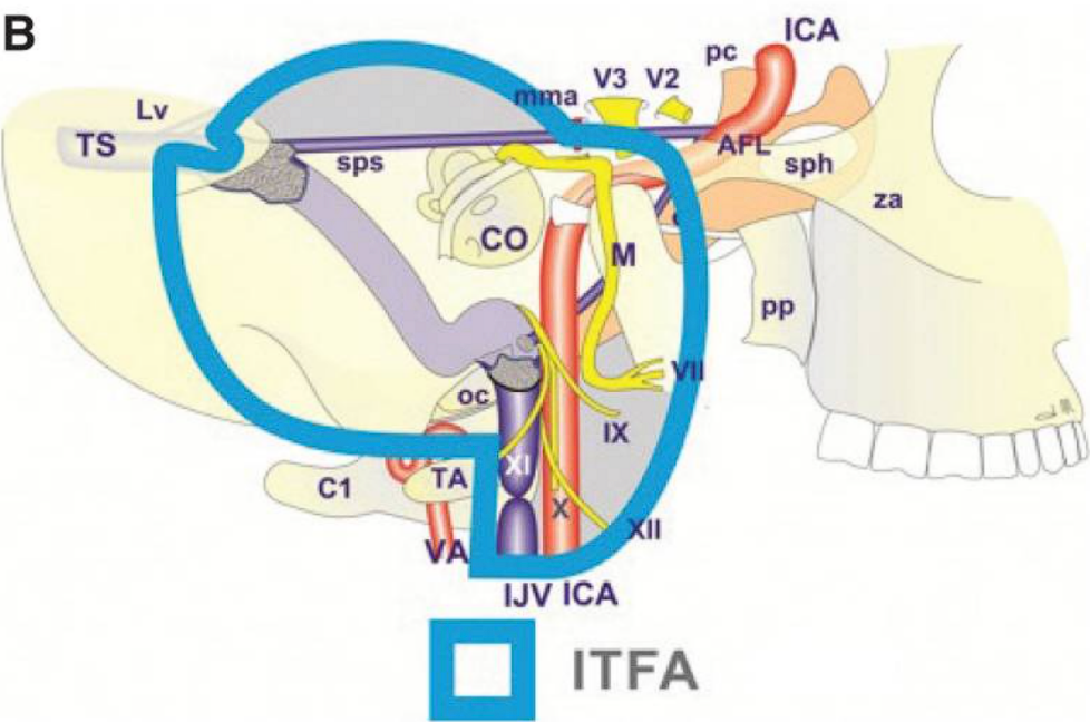 Lv SPS ICA co IJV ICA ITFA 