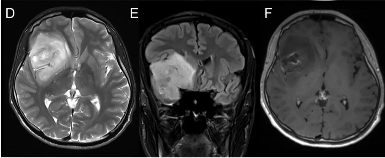 A close-up of a brain scan AI-generated content may be incorrect.