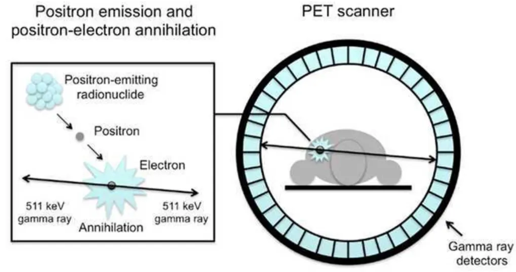 PET scan
