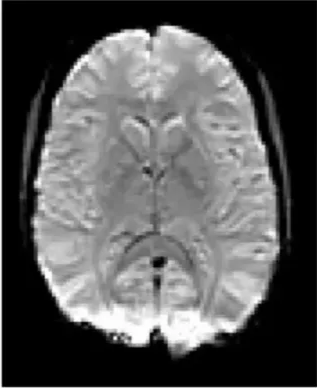 T2* - weighted EPI scan 3T