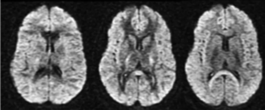 Diffusion source images obtained with gradients applied along the x-, y-, and z-directions