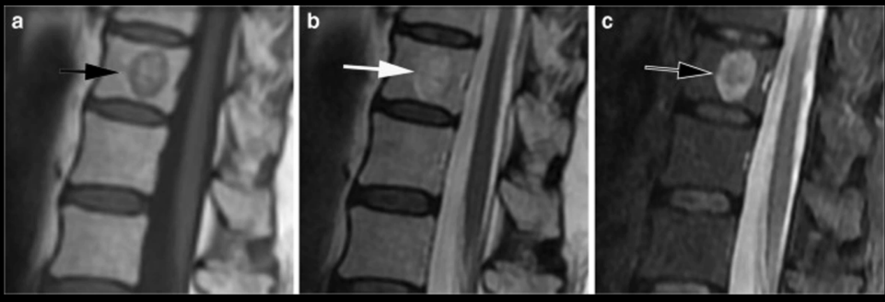 An x-ray of a spine AI-generated content may be incorrect.