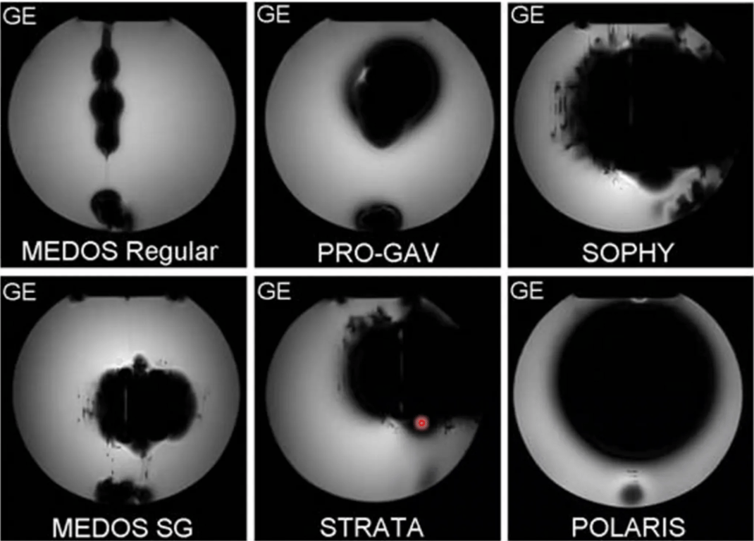 Distortion of Gradient-Echo image by different valve types
