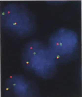 Fig. 3.16 RELA Interphase FISH with fusion-positive ependymoma. break-apart probes RELA gene. Overlapping probes (yellow) intact RELA gene, but probe separation occurs with rearrangement of the RELA gene. around the indicate an (red/green) 
