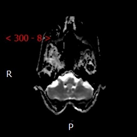 A close-up of an mri AI-generated content may be incorrect.