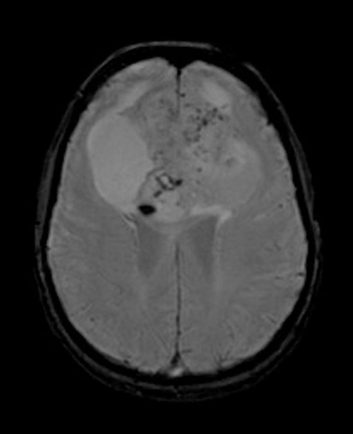 A close-up of a brain scan AI-generated content may be incorrect.