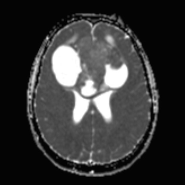 A close-up of a ct scan AI-generated content may be incorrect.
