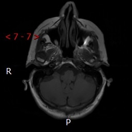 A close-up of an x-ray AI-generated content may be incorrect.