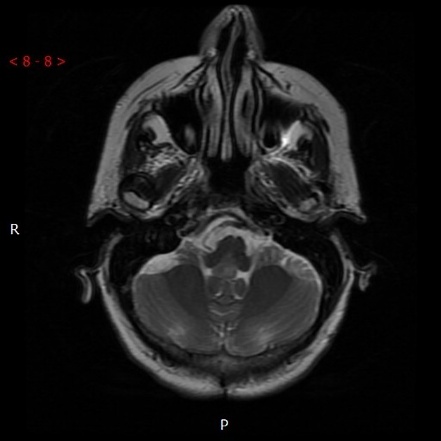 A close-up of an mri AI-generated content may be incorrect.