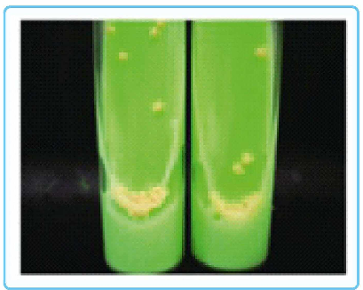 Lowenstein-Jensen medium 