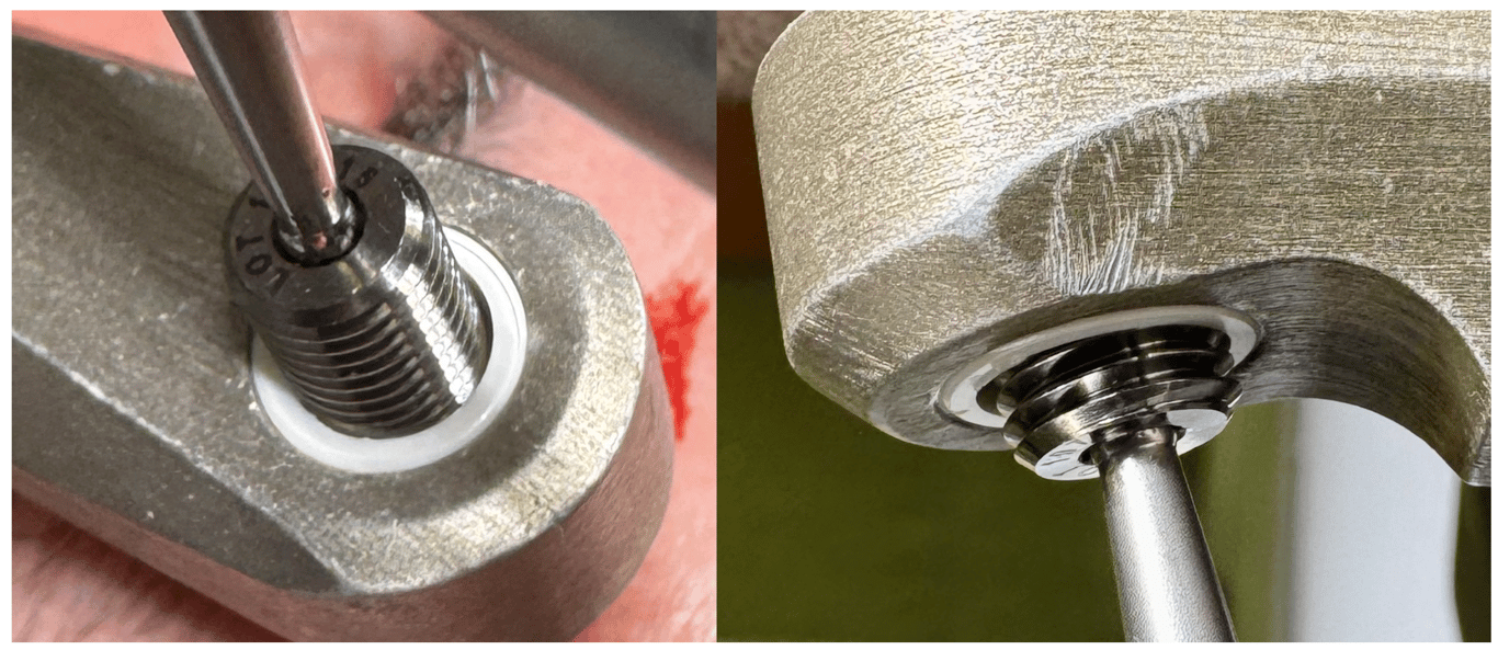 Perfecting your registration: the sphere of the ball of the RSOA arm should be halfway into the pin site hole, as shown in examples here.