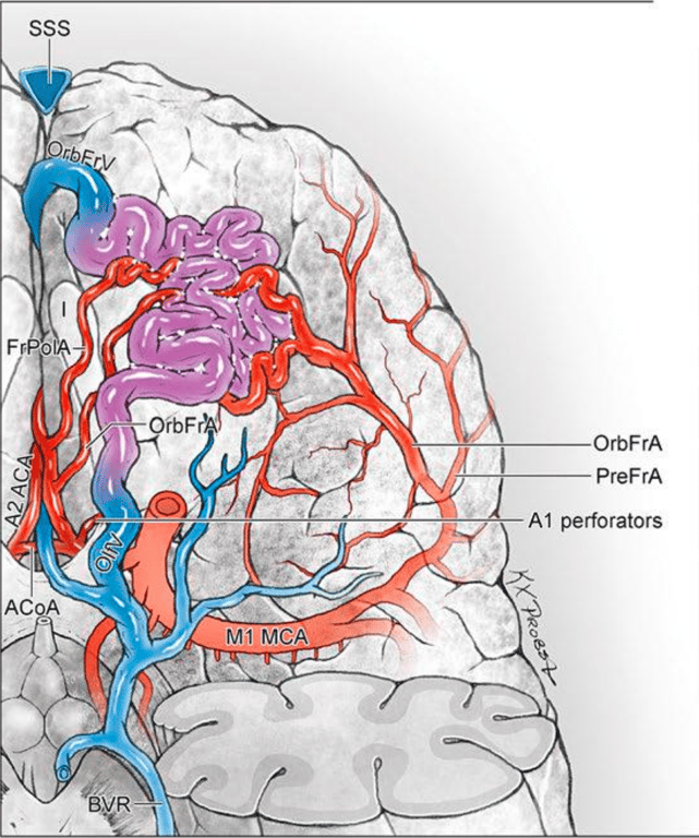 inferior (with left temporal pole removed)