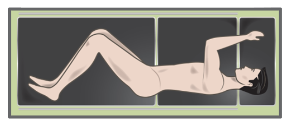 Hips bent to keep the psoas lax 