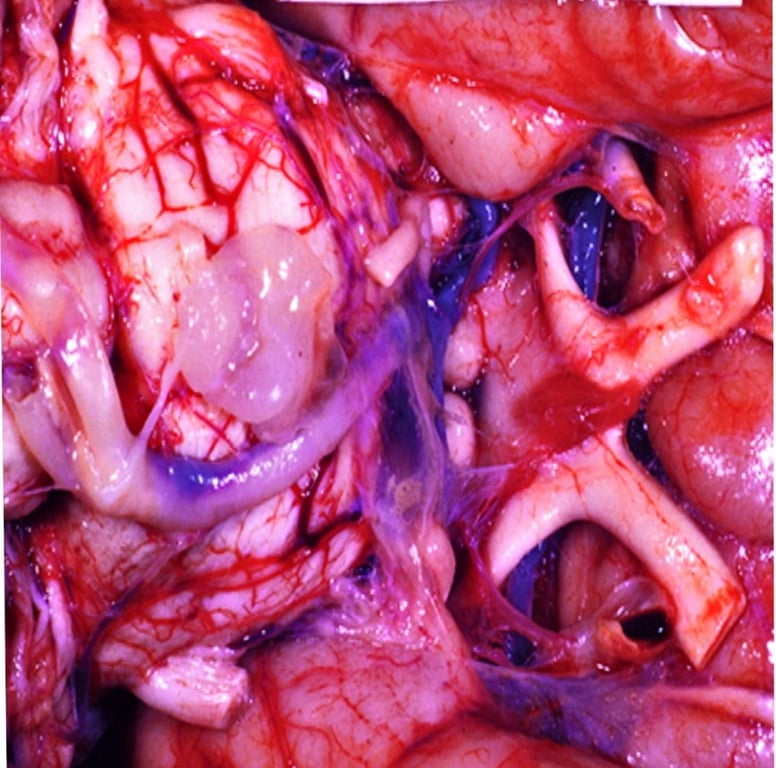 Close-up of a human body AI-generated content may be incorrect.