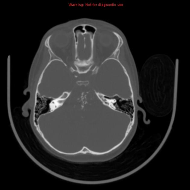 Warning: Not for diagnostic use 