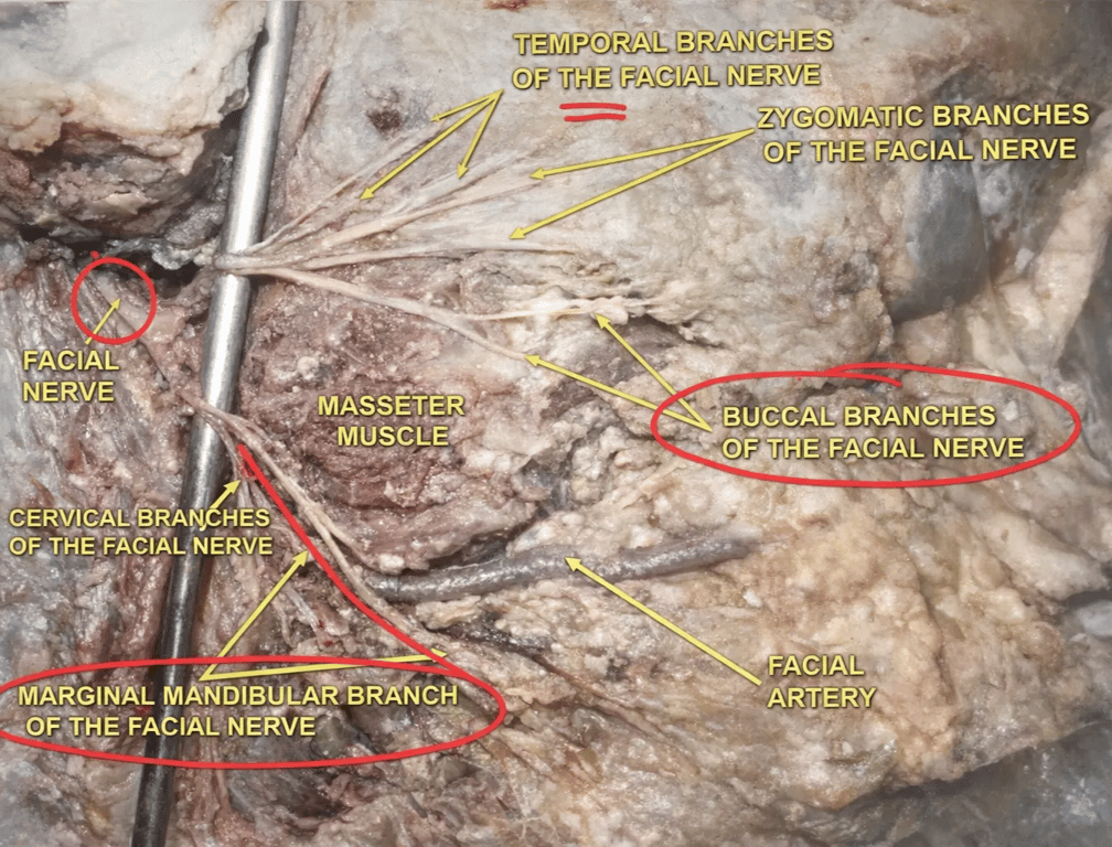 Identify → Important