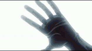 notion image