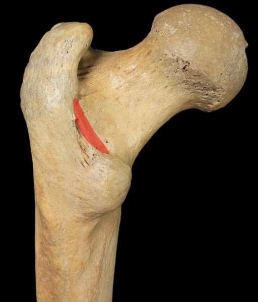 Quadratus tubercle - Attachment fo quadratus femoris