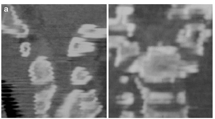 A blurry image of a person AI-generated content may be incorrect.