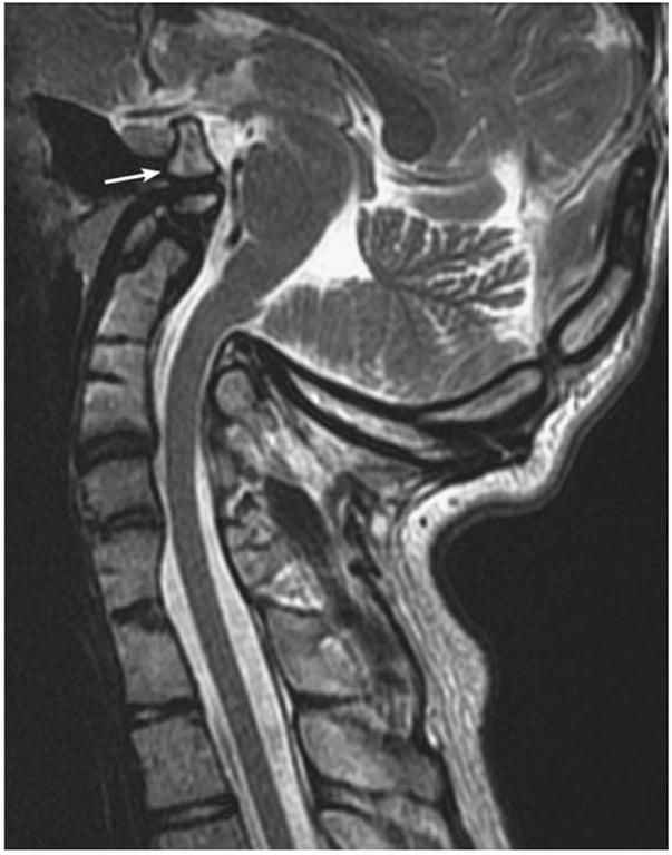 A close-up of a mri scan AI-generated content may be incorrect.