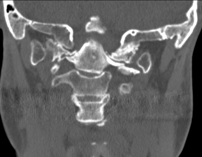 A close-up of an x-ray AI-generated content may be incorrect.