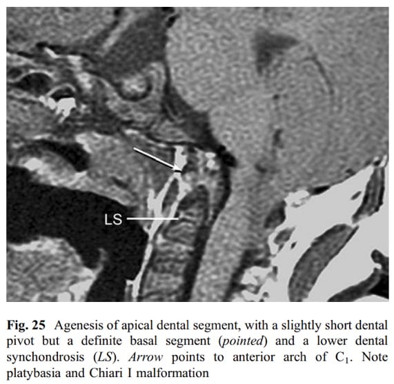 A close-up of a scan of a human body AI-generated content may be incorrect.